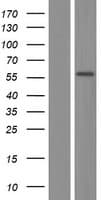 Human PGM1 / Phosphoglucomutase 1 Protein (Over-Expression Lysate Myc-DDK (Flag))