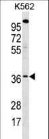 WBSCR22 Antibody (aa253-281)