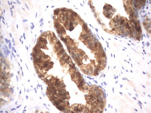 MSMB / MSP Antibody (clone UMAB147)