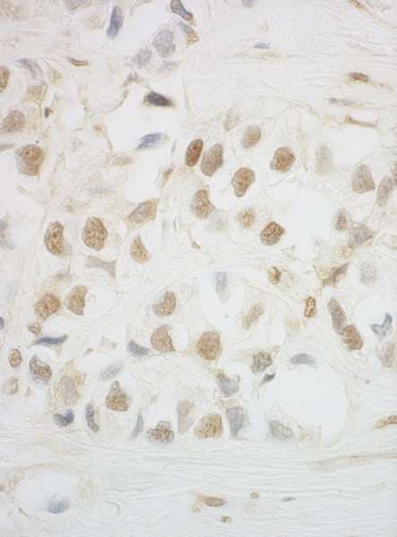 UTP6 Antibody (aa565-597)