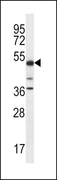 PSTPIP1 Antibody (aa89-118)