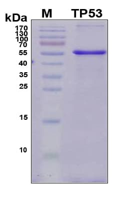 Human TP53 / p53 Protein (Recombinant 6His, N-terminus)