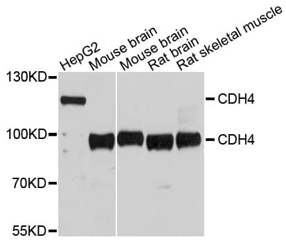 CDH4 / R Cadherin Antibody