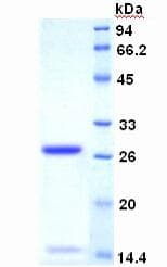 Human MKI67 / Ki67 Protein (Recombinant His, N-Terminal)