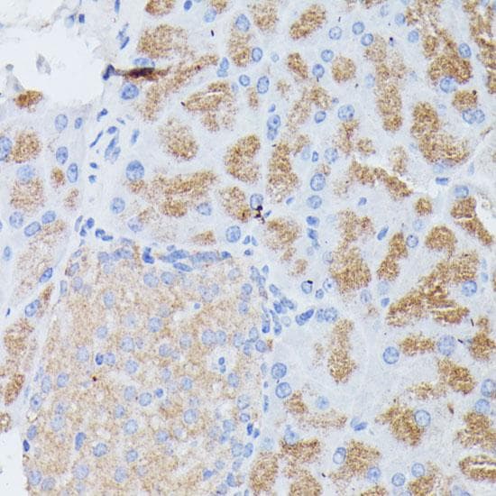 Polyclonal Rabbit anti-Human PLA2G1B Antibody (IHC, WB)