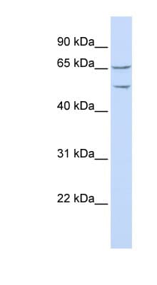 HTTY1 / TTYH1 Antibody (N-Terminus)