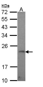 CR6 / GADD45G Antibody (aa96-159)