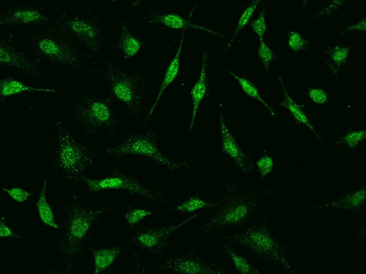 HSPB8 / H11 / HSP22 Antibody