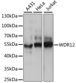 Polyclonal Rabbit anti-Human WDR12 Antibody (WB)