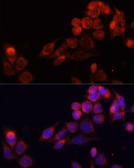 Polyclonal Rabbit anti-Human SLC16A4 Antibody (IHC, IF, WB)