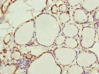 RNF114 / ZNF313 Antibody