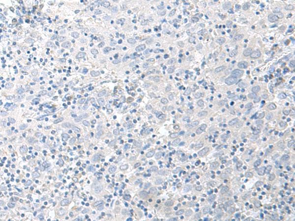 STAU2 Antibody