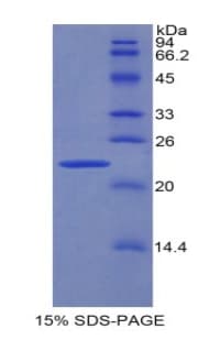 Rat PPARG / PPAR Gamma Protein (Recombinant His)