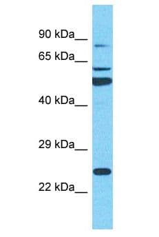 SRRM3 Antibody (aa50-99)