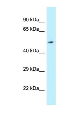 ALDH3B2 Antibody (aa39-88)