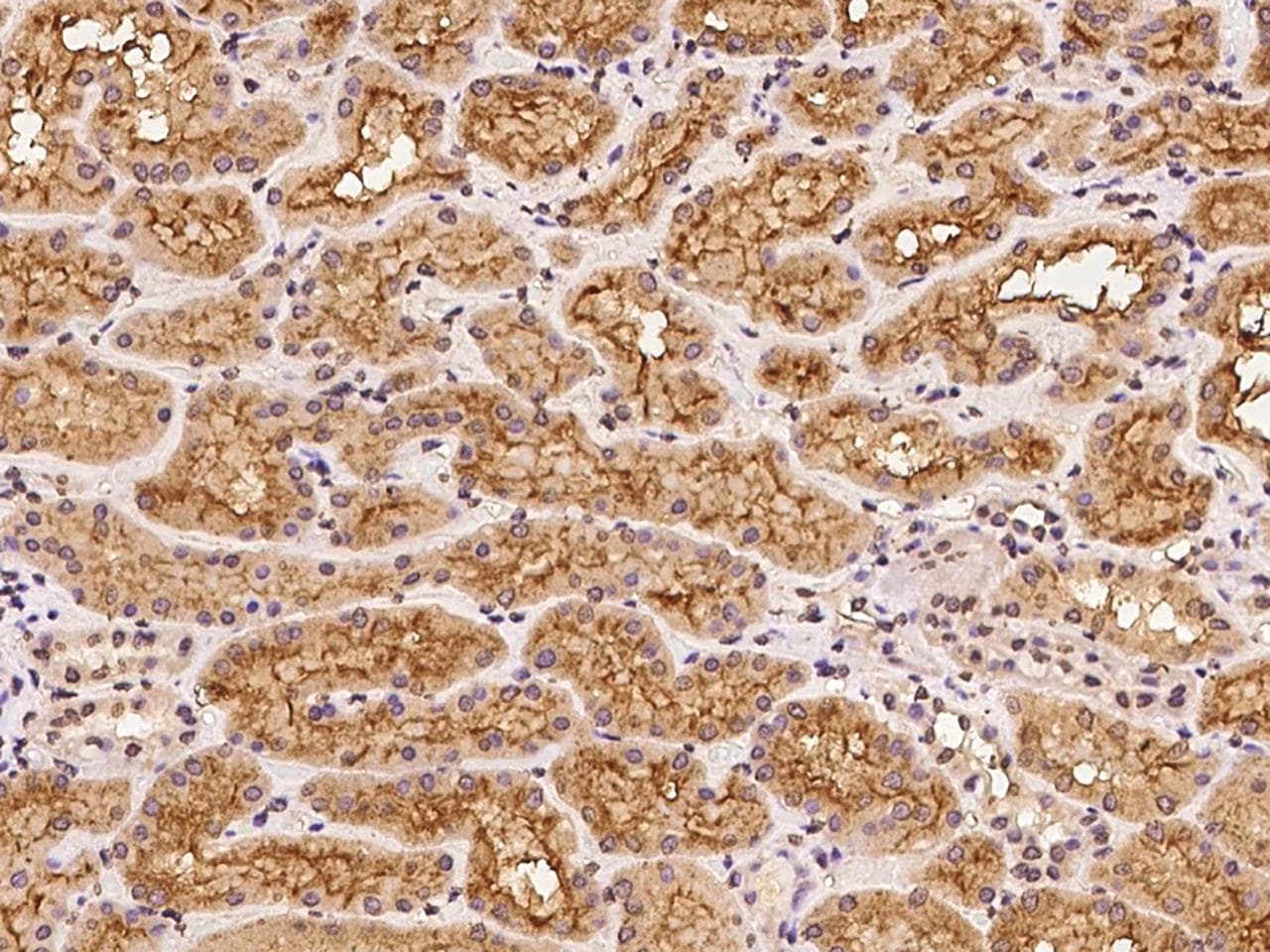 CLPX Antibody
