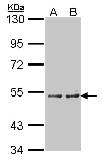 Polyclonal Rabbit anti-Human CYP4A11 Antibody (aa48-316, IHC, WB)