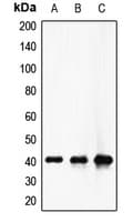 Polyclonal Rabbit anti-Human F12 / Factor XII Antibody (Internal, WB)