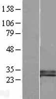 DKK1 Protein (Over-Expression Lysate Myc-DDK (Flag))