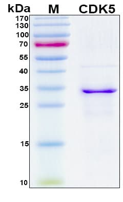 Human CDK5 Protein (Recombinant 6His, N-terminus)