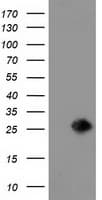 Monoclonal Mouse anti-Human LIN7B Antibody (clone OTI1D12, IF, WB)