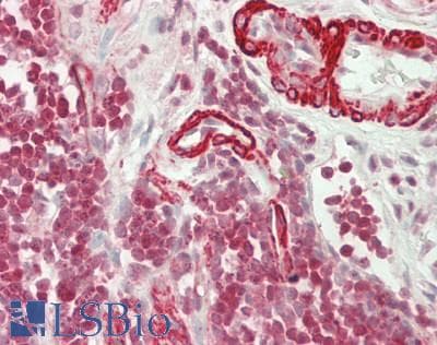 IHC-plus™ RAB31 Antibody (Internal)