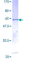 Human CDK5 Protein (Recombinant GST)