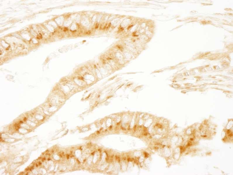 PRKAR2A Antibody (aa50-100)