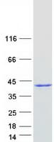 Human NPM1 / NPM / Nucleophosmin Protein (Recombinant Myc-DDK (Flag))