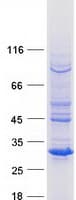 Human KCTD14 Protein (Recombinant Myc-DDK (Flag))