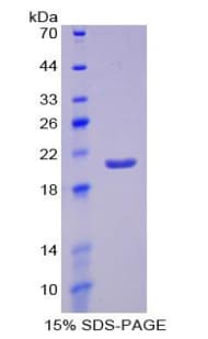 Mouse EPO / Erythropoietin Protein (Recombinant His-S)