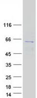 Human CDKAL1 Protein (Recombinant Myc-DDK (Flag))
