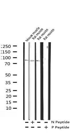 CALD1 / Caldesmon Antibody (phospho-Ser789)