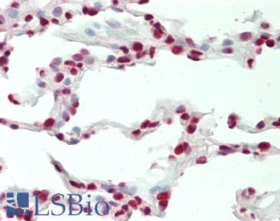 IHC-plus™ CBX4 Antibody (aa150-200)