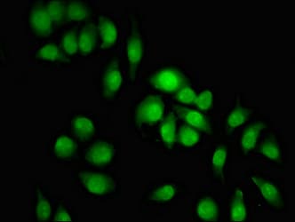 KDM2B / FBXL10 Antibody