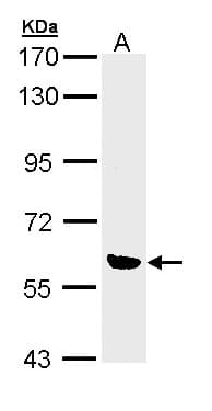 Polyclonal Rabbit anti-Human OXSR1 / OSR1 Antibody (aa1-281, WB)