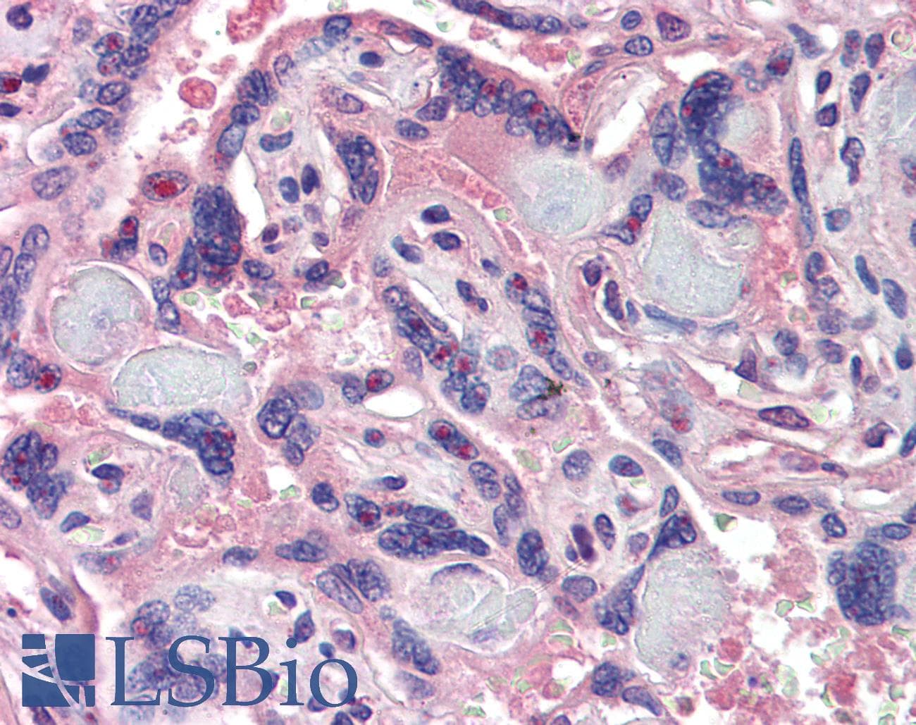 IHC-plus™ Polyclonal Goat anti-Human NCOA3 / SRC-3 / AIB1 Antibody (aa188-198, IHC)