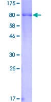 Human HCK Protein (Recombinant GST)