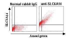 Polyclonal Rabbit anti-Human SLC6A14 Antibody (IHC, WB)