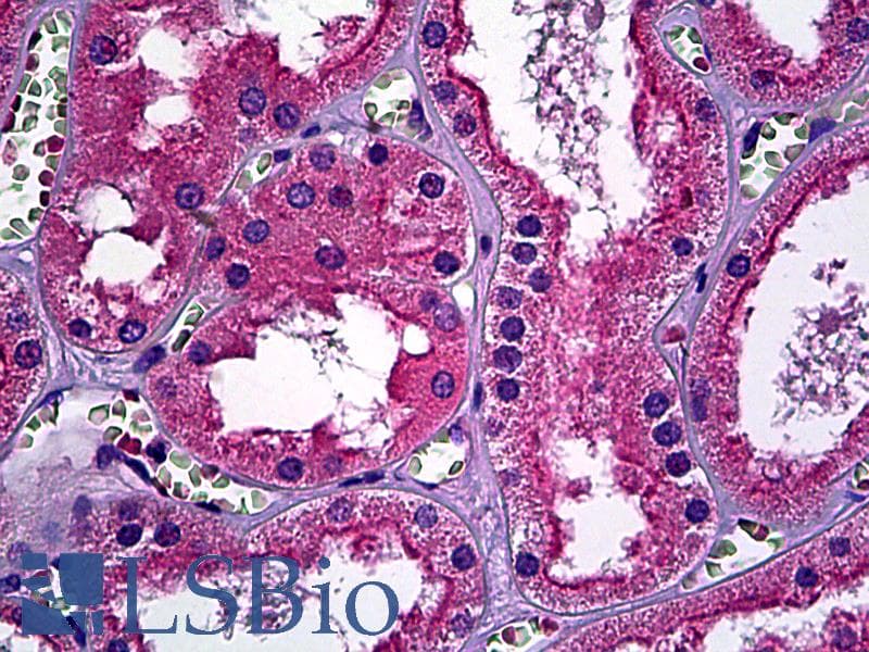 IHC-plus™ ERBB3 / HER3 Antibody (clone 2C7)