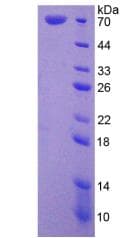 Human HSPA1L Protein (Recombinant His)