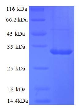 Human CA12 / Carbonic Anhydrase XII Protein (Recombinant His)
