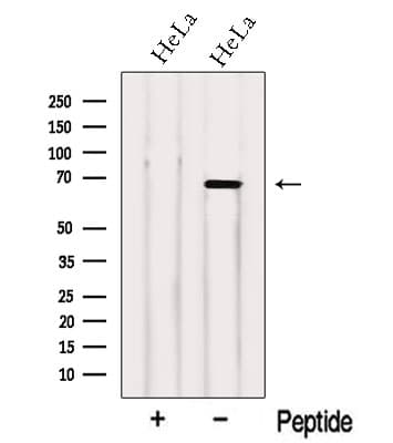 Polyclonal Rabbit anti-Human NCOA5 Antibody (WB)