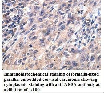 ARSA / Arylsulfatase A Antibody (aa301-493)