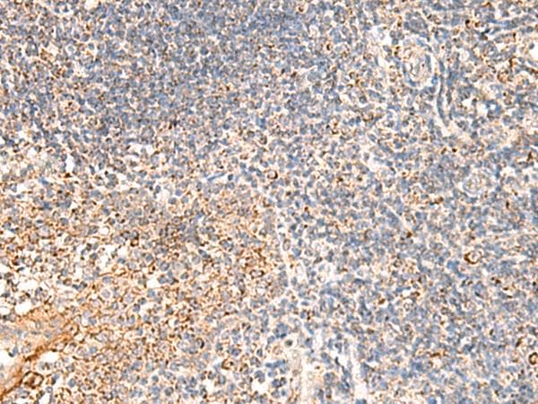 Polyclonal Rabbit anti-Human DUSP7 Antibody (IHC)