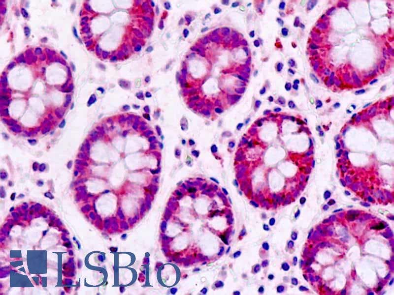 IHC-plus™ SMAD1 Antibody (aa153-202)