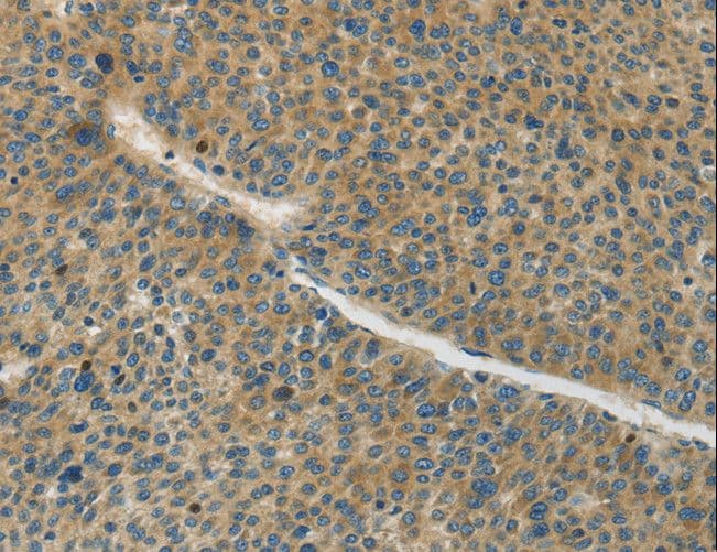 Polyclonal Rabbit anti-Human GJC1 / CX45 / Connexin 45 Antibody (IHC)