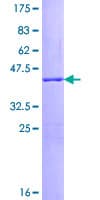 Human SNCG / Gamma-Synuclein Protein (Recombinant GST)