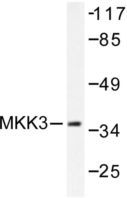 MAP2K3 / MEK3 / MKK3 Antibody (Ser183)