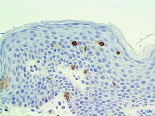 Monoclonal Mouse anti-Human TNFRSF4 / CD134 / OX40 Antibody (IHC)